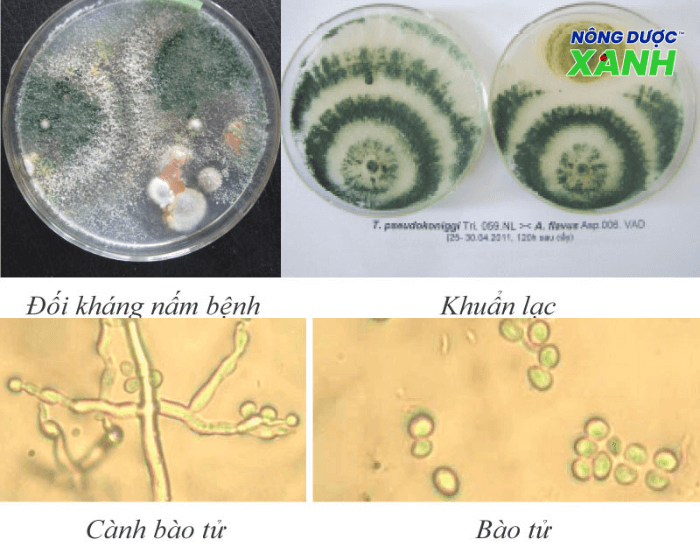 uploads2f20242f072f212fa40b1f138b5c23ab84f46051502bfccb6e02bc8a2fnam-doi-khang-trichoderma nam-doi-khang-trichoderma.png